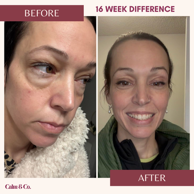 PDRN Cellular-Lift Eye Patches