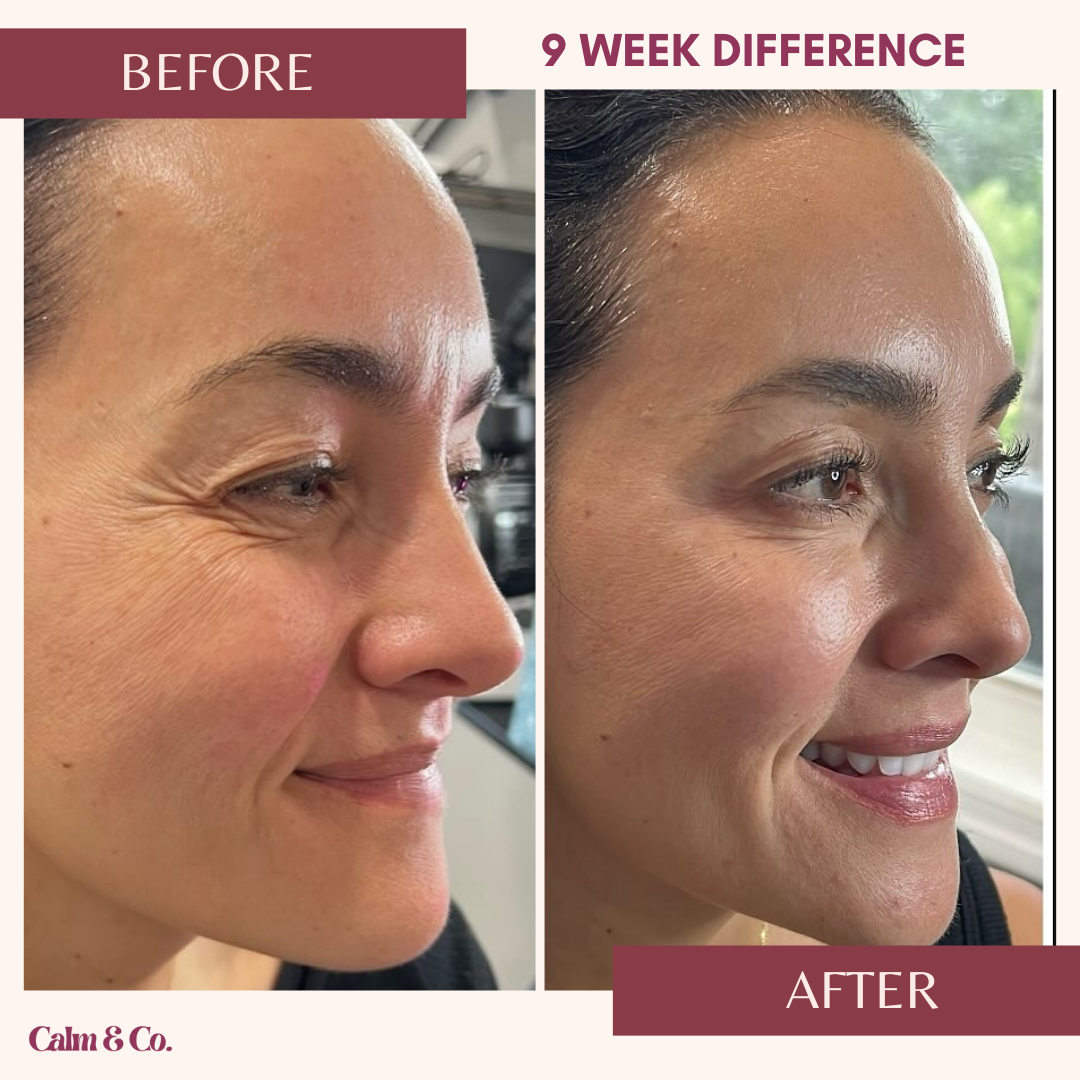 PDRN Cellular-Lift Eye Patches