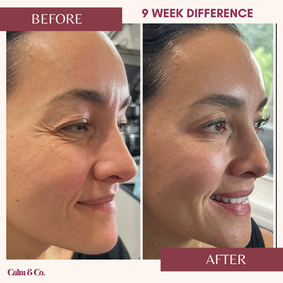 PDRN Cellular-Lift Eye Patches