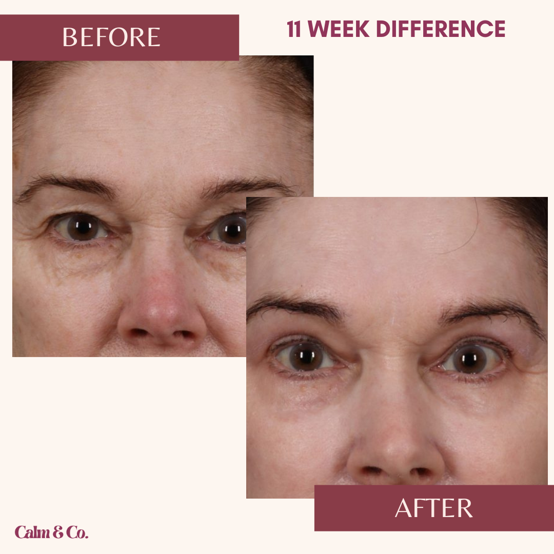 PDRN Cellular-Lift Eye Patches
