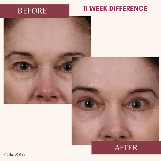 PDRN Cellular-Lift Eye Patches