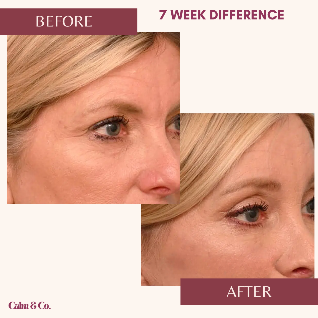 PDRN Cellular-Lift Eye Patches